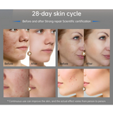 Dr. Pen M9 Microneedling Pen