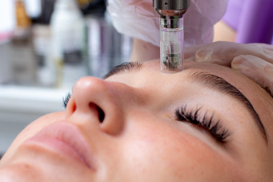 Combining Microneedling with Other Skincare Treatments