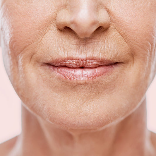 Can we get rid of fine lines and wrinkles?