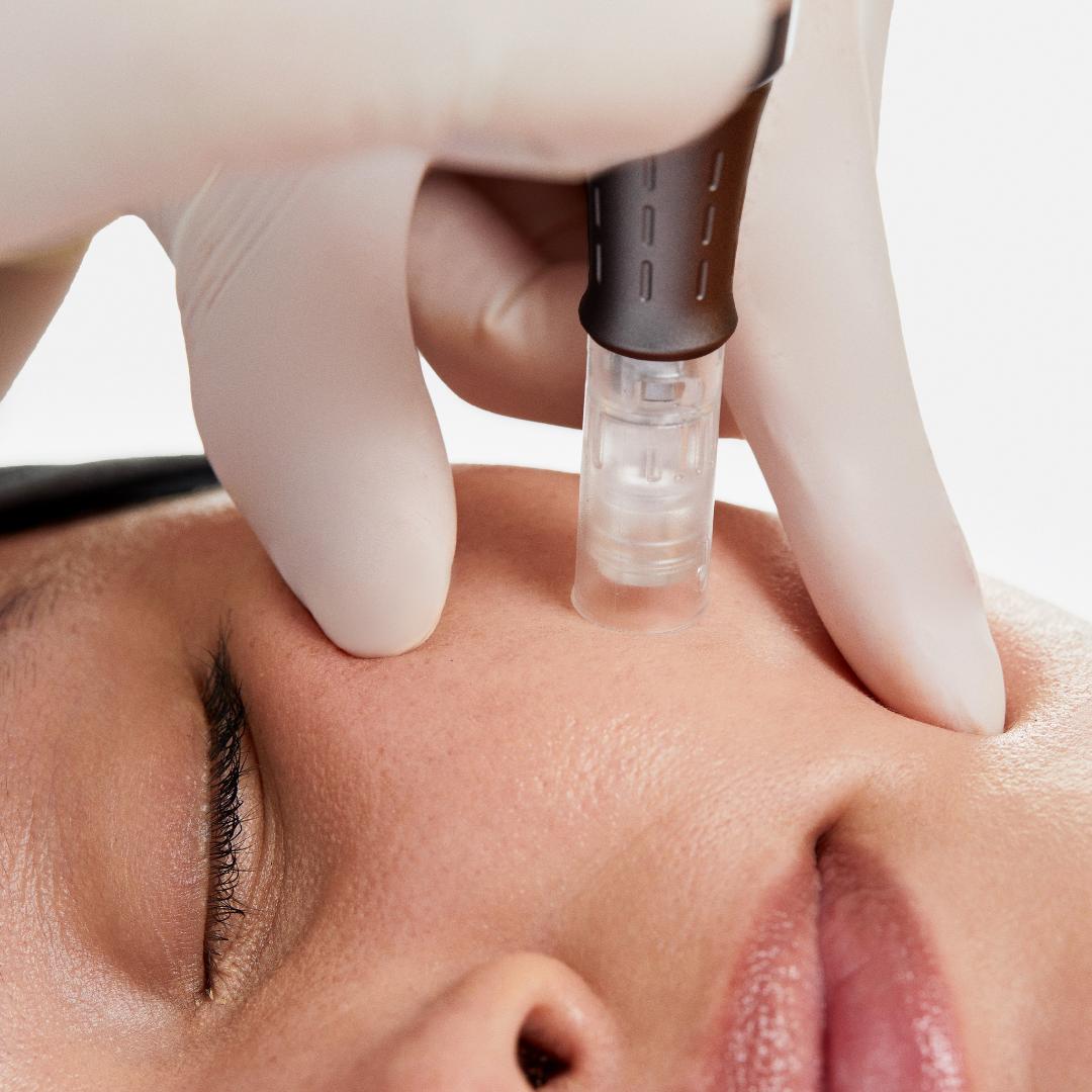 Micro-Needles vs. Nano-Needles: Which Should You Use with Dr. Pen Microneedling Pens?