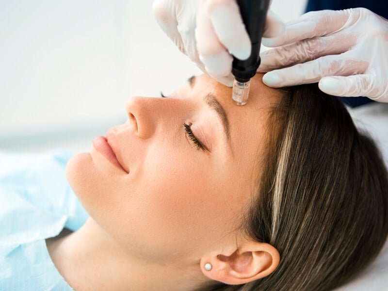 Microneedling benefits