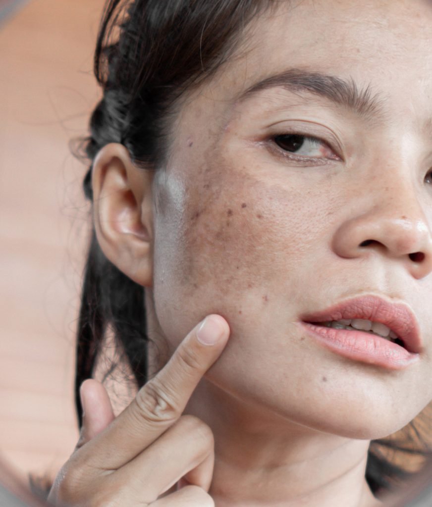 How to Spot Signs of Sun Damage – Dr. Pen Store