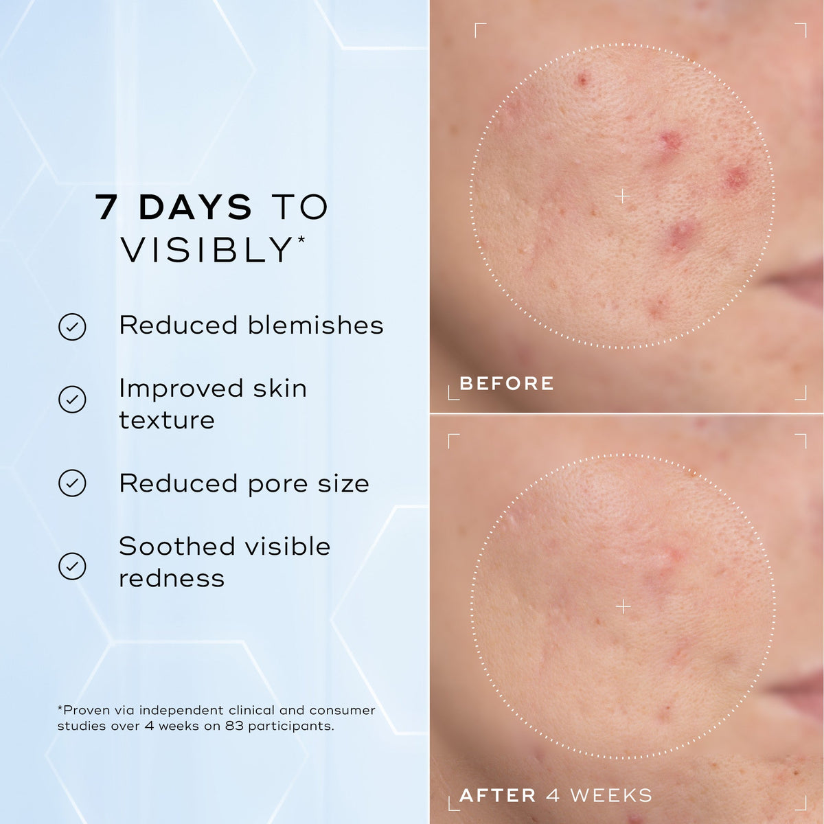 Niacinamide Peptides before and after 4 weeks, skin texture