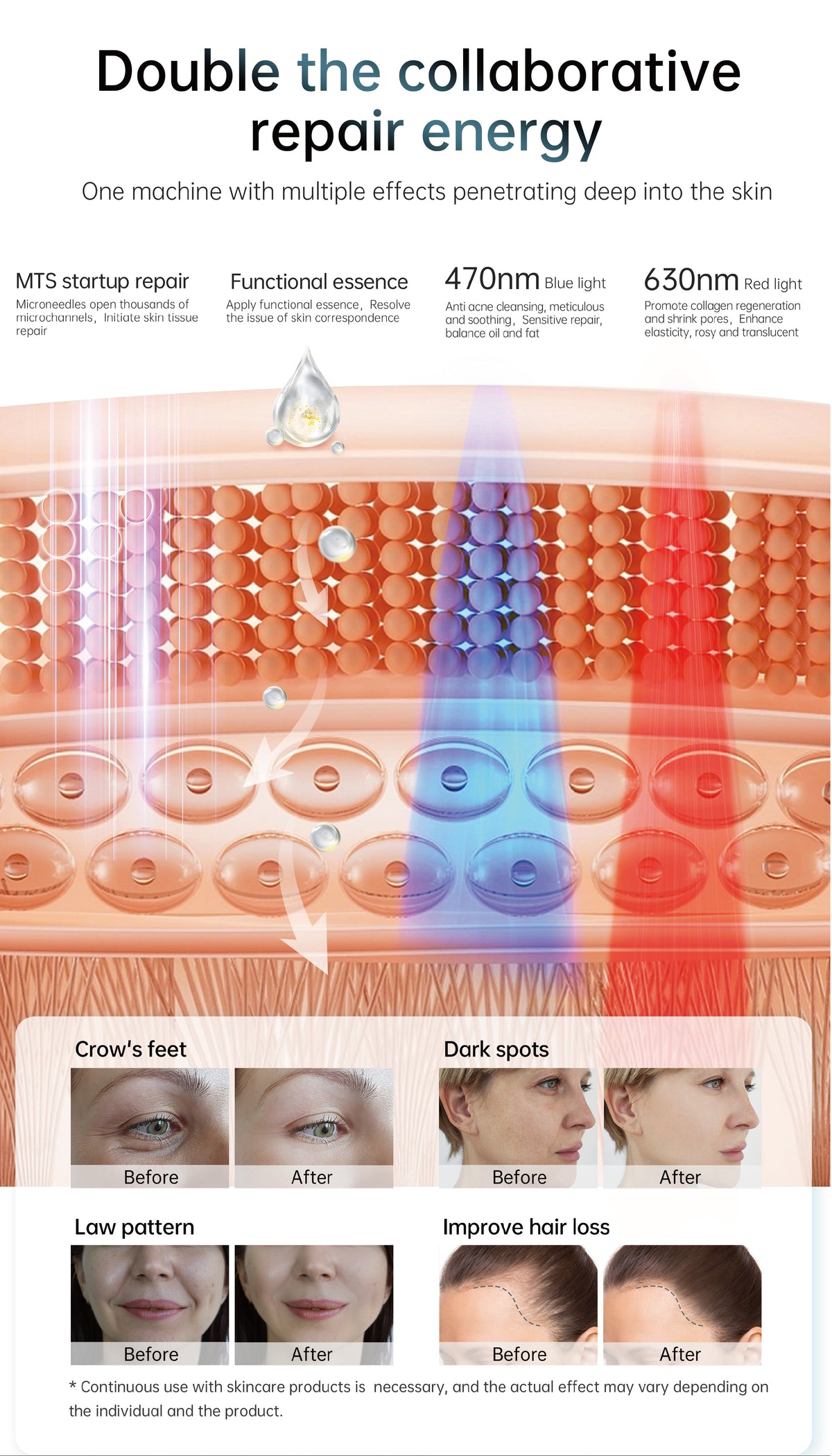 Hydra Pen H6 Advanced Serum Infusion Microneedling Pen with Light Therapy